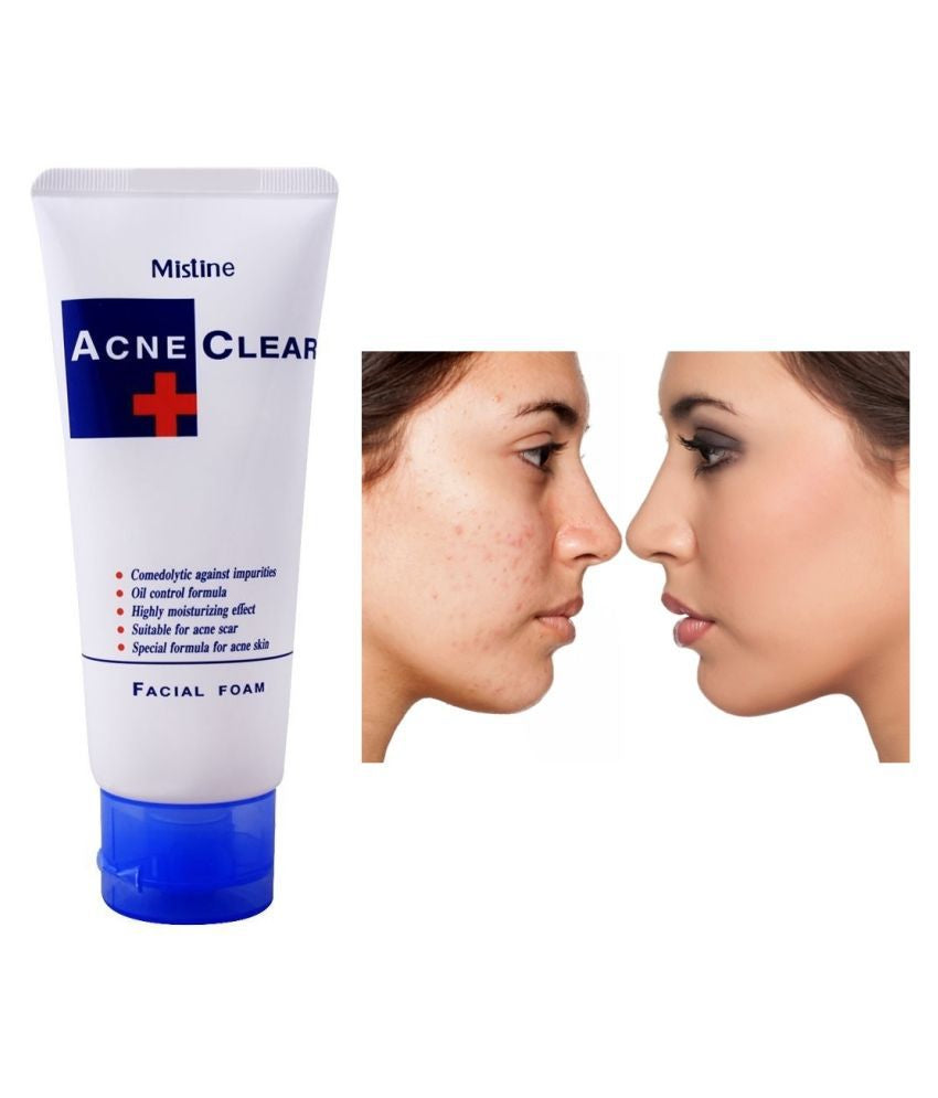 Mistine acne clear face wash 85g